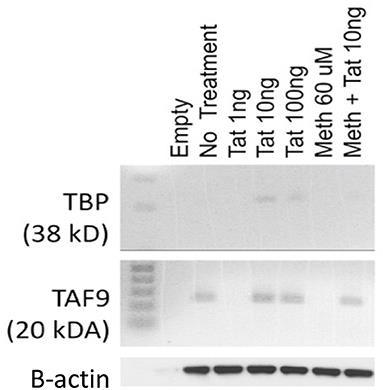 Modeling the Function of TATA Box Binding Protein in Transcriptional Changes Induced by HIV-1 Tat in Innate Immune Cells and the Effect of Methamphetamine Exposure